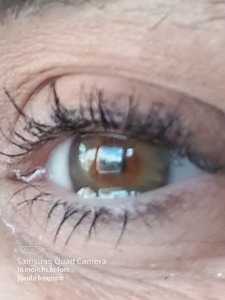 Close up of eye